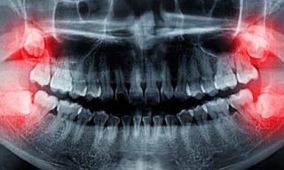 3D CBCT & OPG Digital