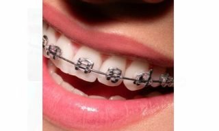 Orthodontics